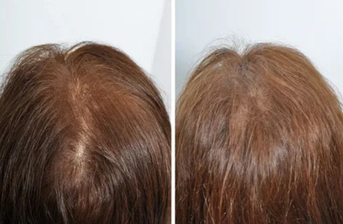 Before & After